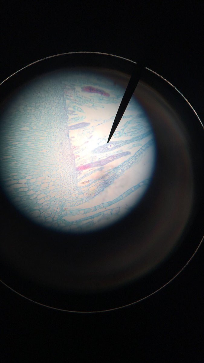 mdude231's tweet photo. Egg located at tip of pointer, between the neck of the archegonia surrounded by the venter at 100x magnification. @NutmegNutz #Bio120sp19 https://t.co/zA4O3SaPjx