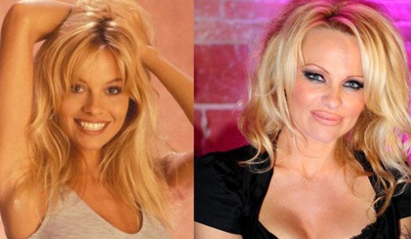 Plastic Surgery's Gone Wrong - epphany.com/site/post/410?…