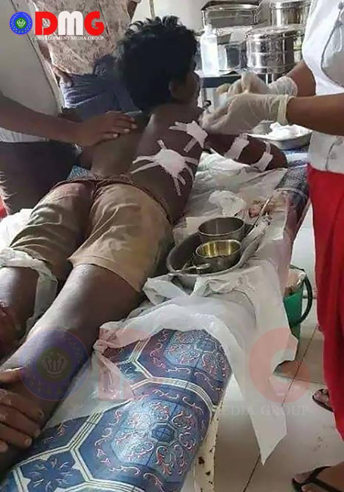 #Myanmar_army (Airforce)'s chopper open fired to Muslims (so-called #Rohingya) near SaiDin waterfall, Buthetaung Tsp. Seven were dead and a large number wounded in fired. It happened at 3pm 2nd of April 2019. Wonders have attended Buthetaung hospital. <a href="/UN/">United Nations</a> <a href="/hrw/">Human Rights Watch</a> <a href="/Refugees/">UNHCR, the UN Refugee Agency</a> <a href="/ICC/">ICC</a>