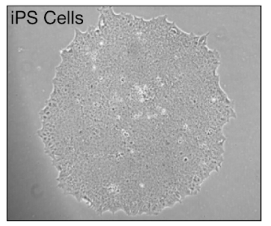 NidheeshDadhich's tweet photo. So happy to share my first batch of human dermal fibroblast cells derived iPS cells converted to hormone positive islet cells. (Ins-Green; Gcg-Red). #iPSC #betcells #Diabetes #ShapiroLab https://t.co/dytJjsBsUz