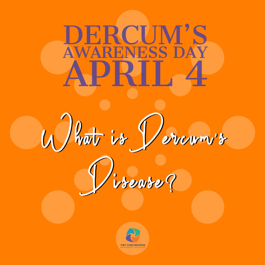 Fat_Disorders's tweet image. #DercumsAwarenessDay Dercum's disease was first described by neurologist Francis Xavier Dercum at the University of Pennsylvania in 1888. Dercum's disease is characterized by painful lipomas in subcutaneous adipose (fat) tissue (SAT). Women are more affected than men. #Dercums