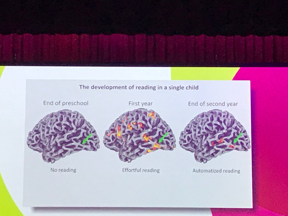 Fabulous opening plenary by ⁦<a href="/StanDehaene/">Stanislas Dehaene @standehaene.bsky.social</a>⁩ at@#DSFconf in Perth. Discussing changes in children’s brains as a function of early reading proficiency. 
You can hear a pin drop in this large auditorium, filled with teachers, SLPs, psychs concerned with early reading success 📚