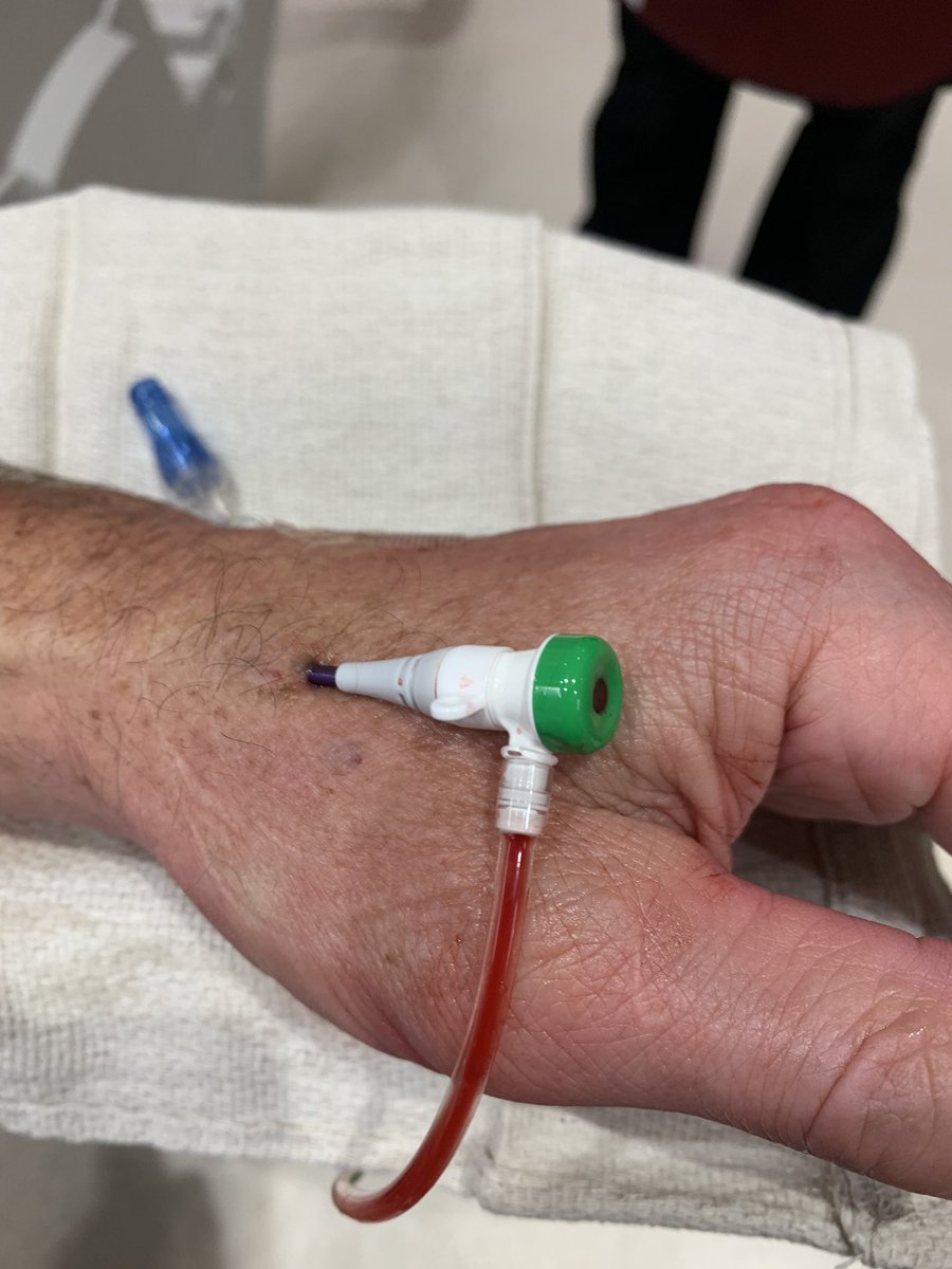 Dr_A_ALQahtani's tweet photo. 1st case #dLRA #PCI case after 4 diagnostic cases of #dLRA. Very efficient way for doing angiogram on CABG Cases and those with no GOOD #rRDA access. #radialFirst
حالة قسطرة علاجية من خلال طرف الشريان الكعبري الايسر. https://t.co/R72gQI1IJL