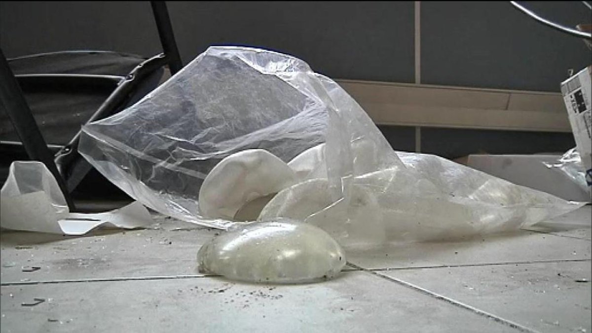RMCInfo's tweet photo. #Protheses
Prothèses mammaires : la France interdit certains modèles liés à un cancer.
➡️ Dr Jacques Saboye, pdt de la Société Française de Chirurgie Plastique, Reconstructrice et Esthétique #SOFCPRE est à 6h40 sur RMC
#BourdinDirect
📻 https://t.co/GRm4N9E6xr https://t.co/l3btgRAvrJ