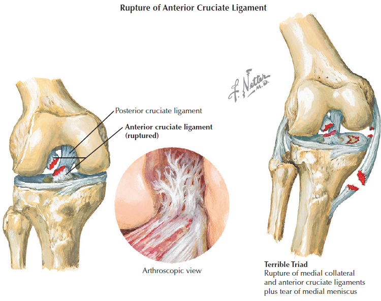 Ligaments Of The Knee Netter