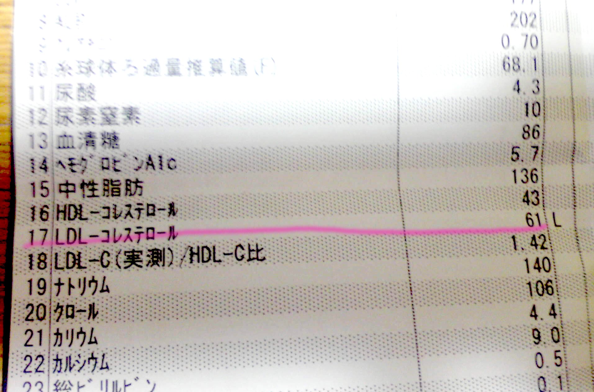 浅美裕子 時々光原伸代理 على تويتر 怖かったので翌日速攻で病院に向かうわたくし 採血されct撮られmri撮られ Mriで脳梗塞見つかりました すごく小さかった いわゆるラクナ梗塞ってやつだったのかな その時点で入院が決定し一週間の点滴生活開始 脳梗塞の成り立ちと