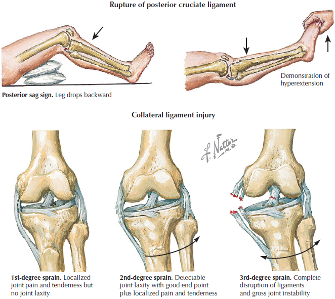 Ligaments Of The Knee Netter