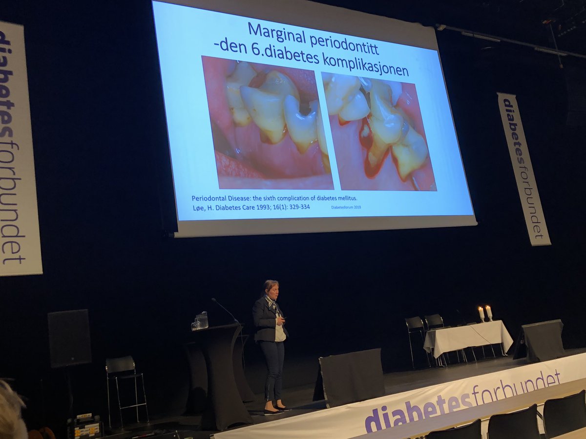 - Marginal periodontitt - den 6. diabeteskomplikasjonen, opplyser tannlege Kristin Kollveit #nasjonaltdiabetesforum2019 #diabetes @Tannlegefor