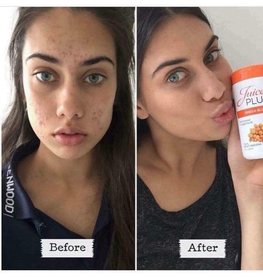 Beautyliciousb3's tweet photo. Not just weight loss!!!😘 Looking for FRESH looking skin......this is the product for you 🙌❤️
Comment or message for info💁 https://t.co/pqsNMxWoxP