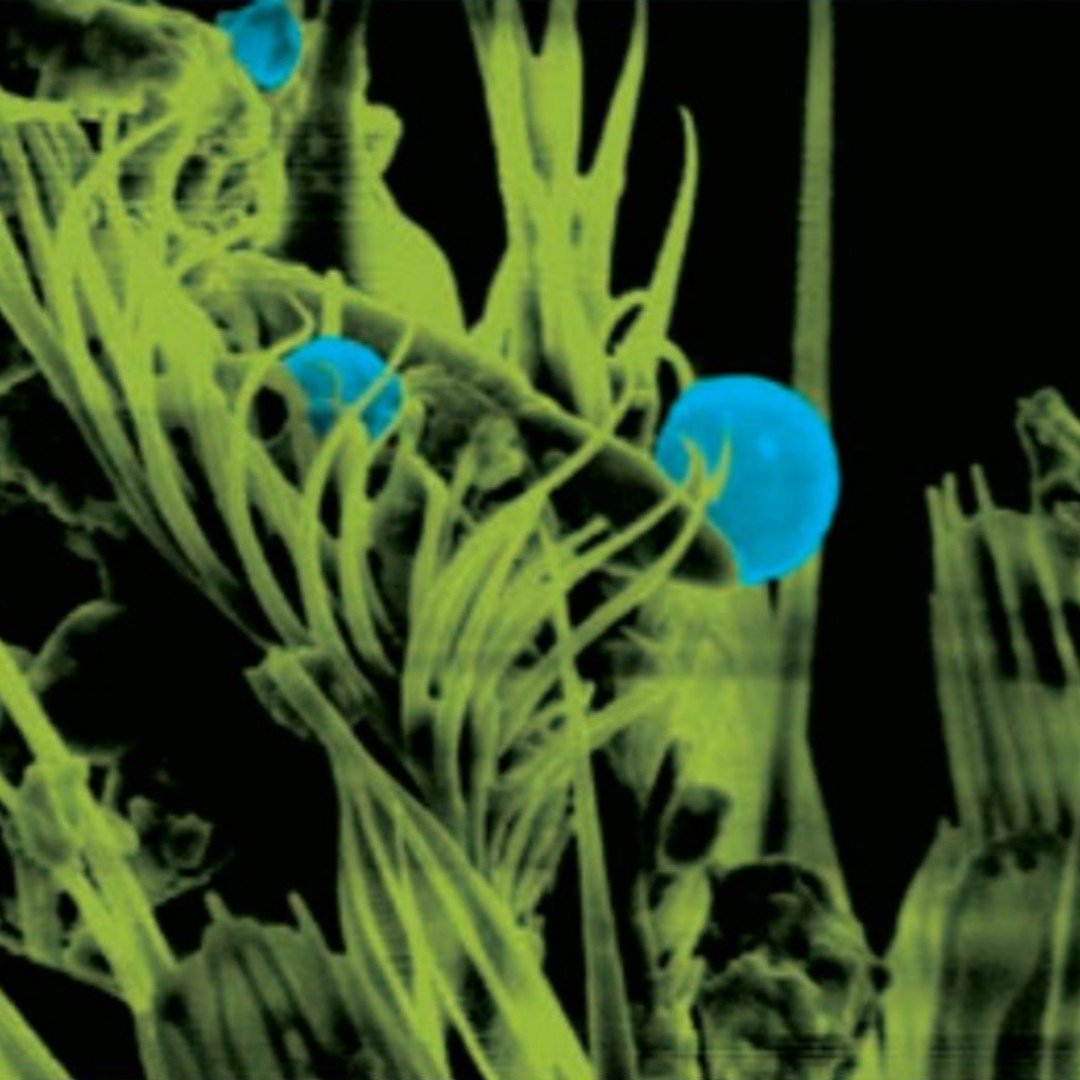 mdgaster's tweet photo. #BugBarometer for the Southeast US, "Residual winter moisture will create ideal conditions for mosquito larval habitats to form in standing water..." Be prepared for mosquitoes this season with guaranteed control for up to 60 days. #SecureChoiceProgram https://t.co/3eA11U0XBw https://t.co/u82rVbZHfv