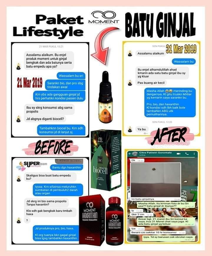 dianastuti86's tweet photo. Sayangi ginjalmu 😍

Ginjal bermasalah langsung di teraphy sebelum kondisi makin parah..
Buat ginjal paket life style moment solusinya.

Info lebih lanjut👇

Wa 081288514757 https://t.co/XhLGiNIejD