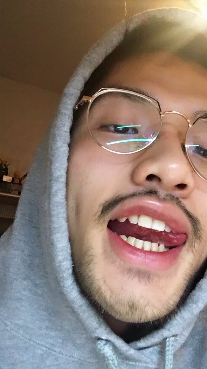 RicooSou's tweet image. #neverhadbracesgang 
#colgatesmile