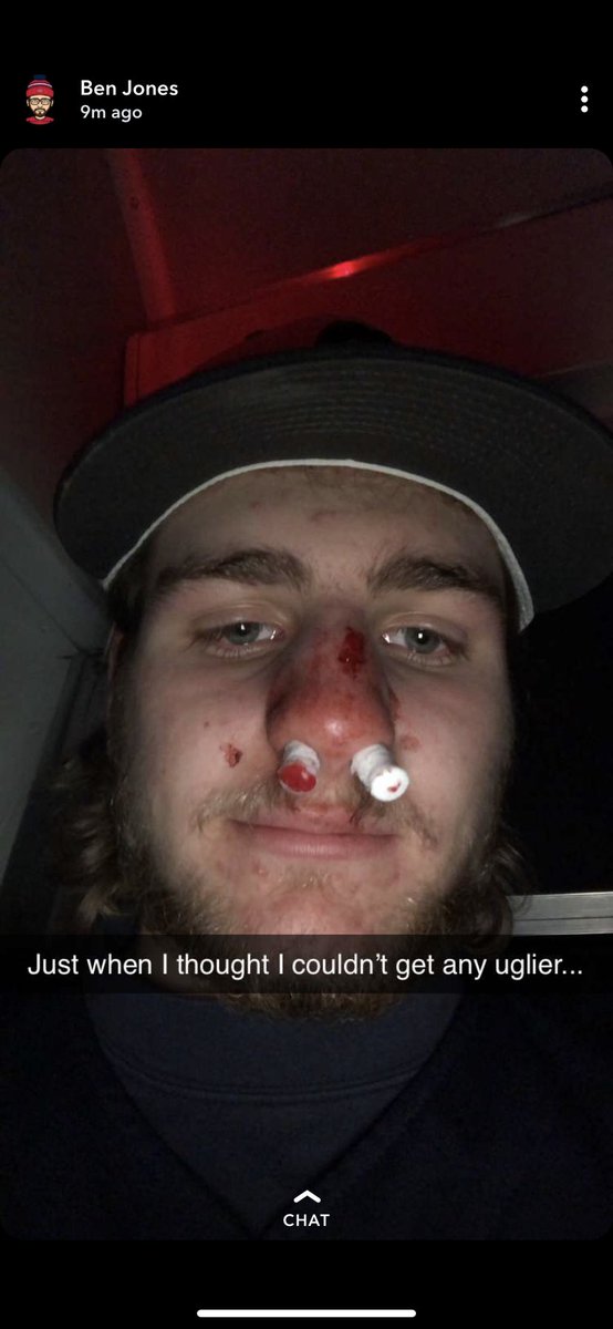 BurgBall19's tweet photo. Burg wins 12-9 over Sauk in 8 innings and sweeps the season series! @WIBallCentral  #roadtotheapple https://t.co/Q946tuTlYq
