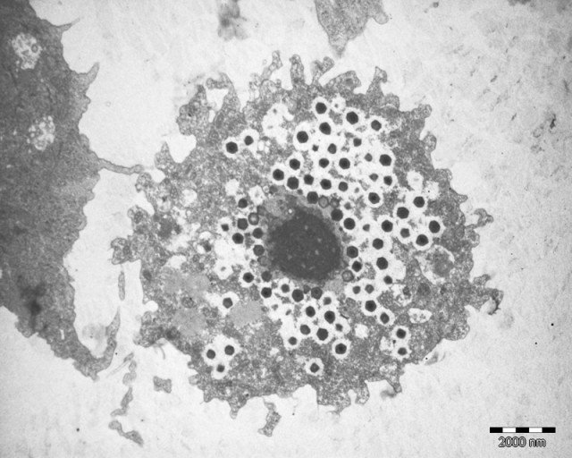 AfghaniHani's tweet photo. 🤔الكل سمع ب باكتيريوفاج #Bacteriophage
لكن #Virophage 🤔
هو عملية اكتشفت 2008
باختصار فيروسات تهاجم فيروسات أكبر داخل خلايا الكائنات الدقيقة مثل الأميبا ...
تم اكتشاف 3 مؤخرا وهي Larry,Curly&amp;Moe

🤔هل يفتح هذا بابا لعلاج💊الفيروسات بالفيروسات
للقراءة👇👇 https://t.co/LcdOsR67VO https://t.co/5VFhWdWAqL