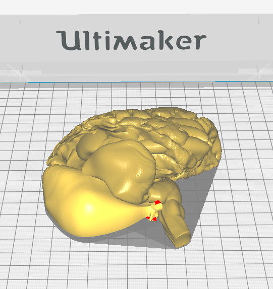 3d_maranon's tweet photo. 3D model printed in two colors representing the Dandy-Walker syndrome which is a group of congenital human brain malformations. @jdeleonluis will use this model to give a seminar for residents at HGUGM. FabLab team @rupermac @calvoharo_ja @diegotrap @kn_ord @sandrasv97 https://t.co/WxyJDBeeLh