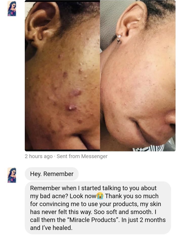 acne cream dischem