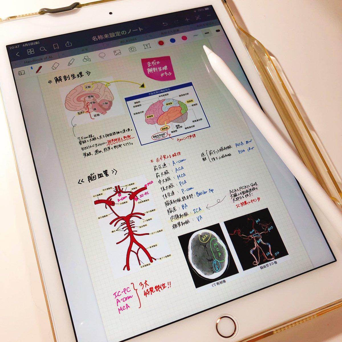 ちゅおnurse Twitter ನಲ ಲ Ipad Pro便利すぎて Goodnotes5という優秀すぎるアプリがありまして ものの数分でノートが完成する これは新人さんに勉強会を開催予定でその資料作り なにこれ なにこれ もう一生愛する ちょっと連投します