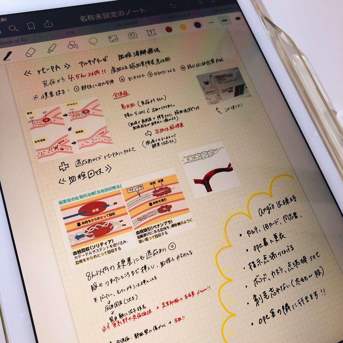 ちゅおnurse Twitter ನಲ ಲ Ipad Pro便利すぎて Goodnotes5という優秀すぎるアプリがありまして ものの数分でノートが完成する これは新人さんに勉強会を開催予定でその資料作り なにこれ なにこれ もう一生愛する ちょっと連投します