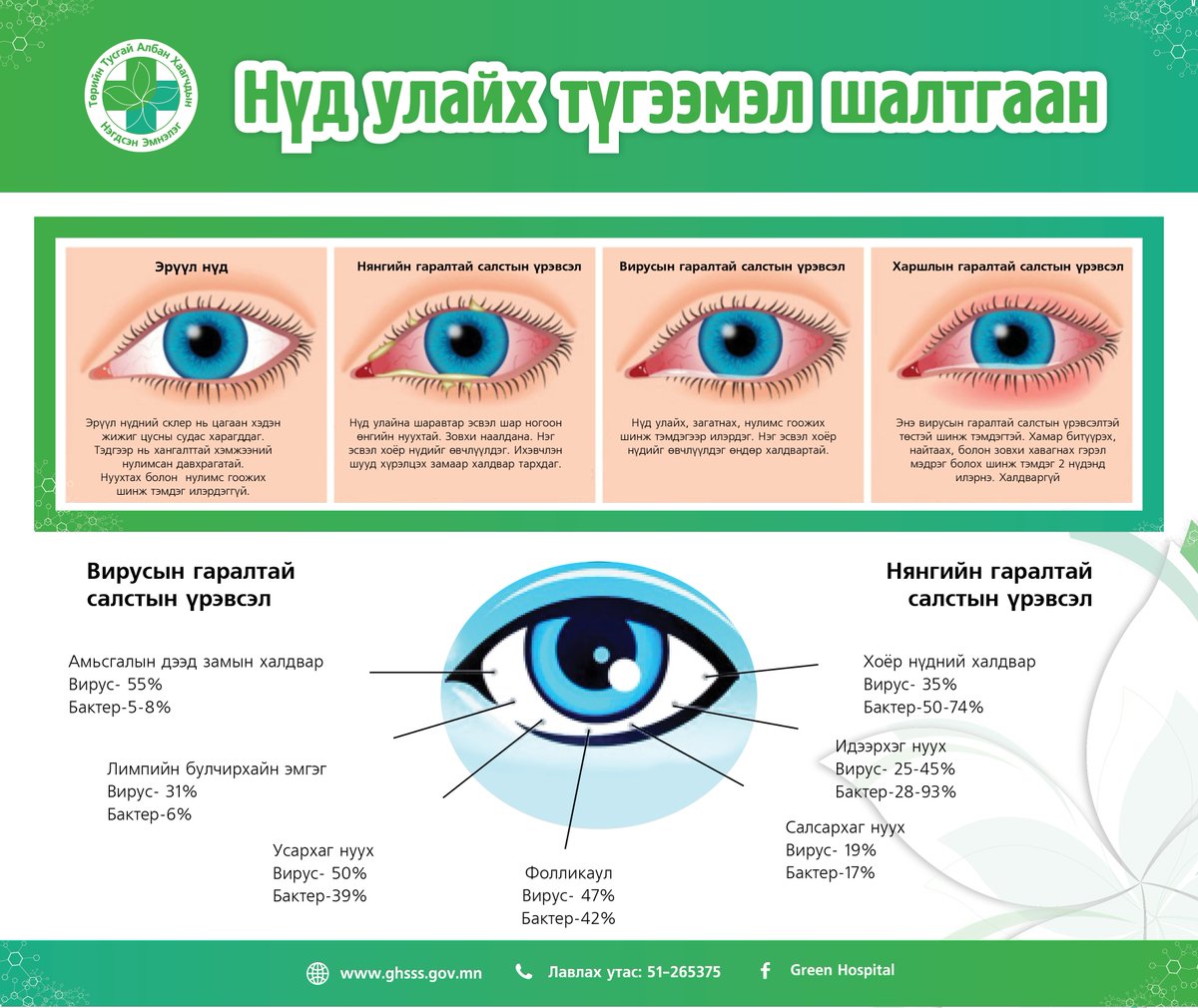 Нүд юунаас болж улайдаг вэ? Дараах мэдээлэлтэй танилцаарай