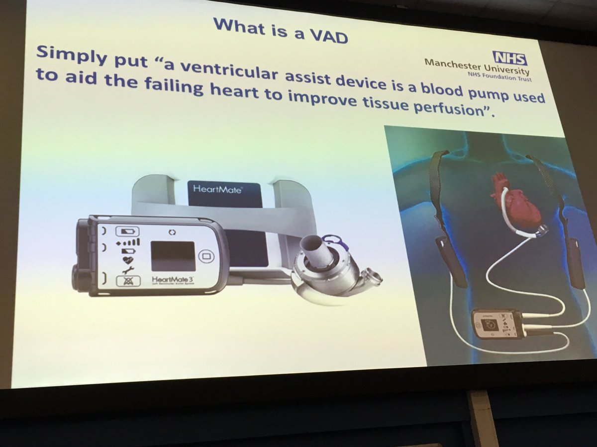 himynameisjaneg's tweet image. Shishir Kore presenting Ventricular Assist Devices sharing experiences of the device as a bridge to transplantation #WTWA Celebrating Excellence in Practice @WythenshaweHosp @AmandaWoodMFT @TntTracy73