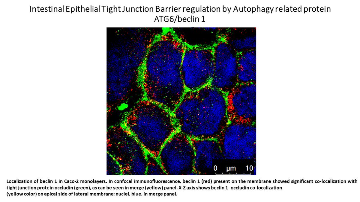 AJPCellPhys's tweet photo. Check out this #ImageOfTheWeek. “Intestinal Epithelial Tight Junction Barrier regulation by Autophagy related protein ATG6/beclin 1” By: Morgan Wong, Ashwinkumar Subramenium Ganapathy, Eric Suchanec, Laura Laidler, Thomas Ma, and Prashant K. Nighot.
DOI: https://t.co/6l1rrdegam https://t.co/V5XseDnKHp