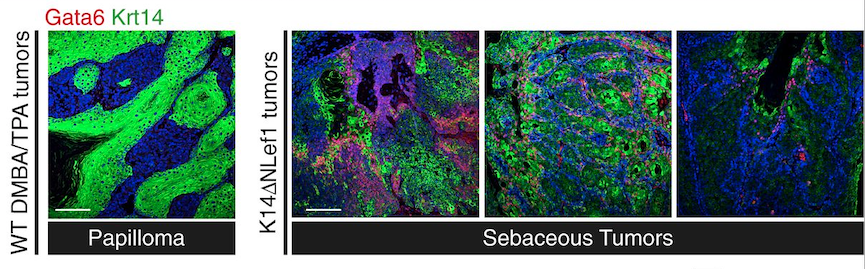 KCLstemcells's tweet photo. Recent paper by Dr Bénédicte Oulès in @embojournal reveals that the transcription factor #Gata6 controls #SebaceousGland development and #cancer
https://t.co/FMStJcCgMJ
@KCLBMBioscience @kingsmedicine @kingshealth @KCLcancer_pharm https://t.co/B4PF2HKtmN