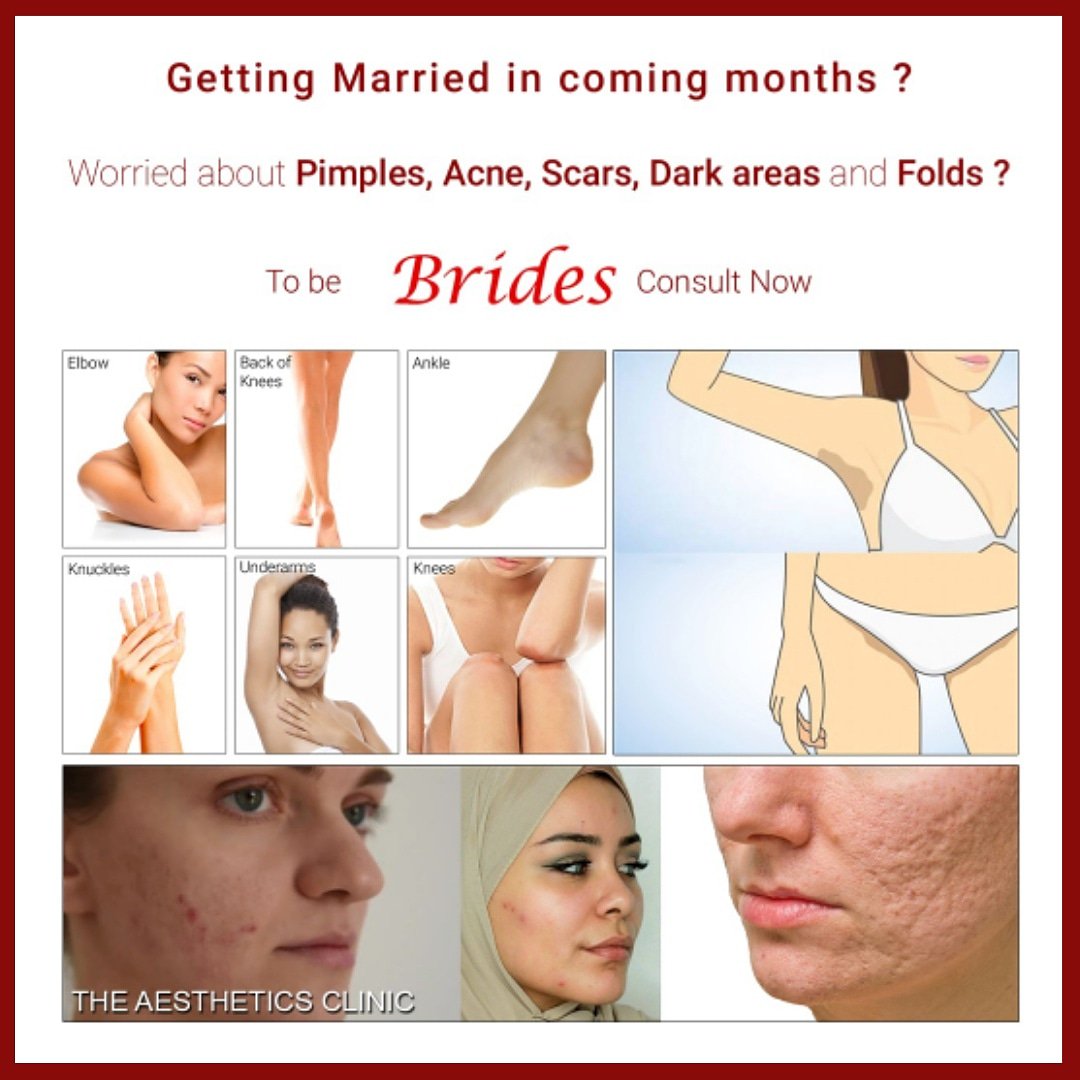 SLACPK's tweet photo. To be BRIDES 👩🏻 Consult Now.
The Aesthetics Clinic.
For appointments please call 0321-1225719 021-38883275 DHA – Karachi.
#DrShaistaLodhi #ShaistaLodhi #acne #pimples #acnescars #armpit #ankle #elbow #knuckles #bikiniarea #darkspots #underarms #knees @IamShaistaLodhi https://t.co/ekVbW72KrQ