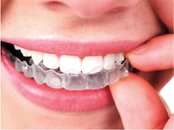 FFOrthodontie's tweet photo. [#Communiqué #Presse] La Fédération Française d'#Orthodontie met en garde contre la technique des #aligneurs, technique "à la mode" actuellement, et rappelle que l’efficacité d'un #traitement ne relève pas du type de traitement #orthodontique choisi -> https://t.co/BRK44pQcas https://t.co/mT1PtNrhGB