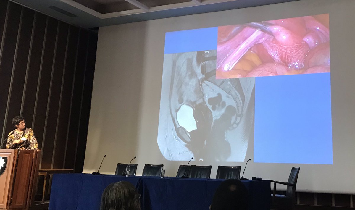 GynaecologyUS's tweet photo. What a great gynaecology imaging meeting at #BSGI #RCOG - all about urogynaecology, mesh, gynae-oncology, fibroids, subfertility, endometriosis and ectopic pregnancy. Also great posters, free communications and Live Scanning - great ! https://t.co/b0GvkZCmfM