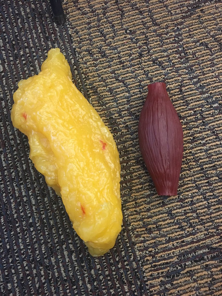 sedela_fcs's tweet photo. These are both 5lbs, one is 5lbs of fat, one muscle. Awesome to see them side by side. Which 5lbs would you choose to walk around with? #kmsfcs #pafcs2019 #SayYesToFCS https://t.co/QoWXo0bH26