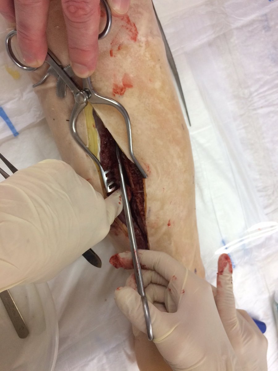 TraumaSimu's tweet image. SAM 2 Fasciotomy model - redesigned with rapidly exchangeable insert for rest between users. Find out more by e-mailing enquiries@traumasimulation.co.uk