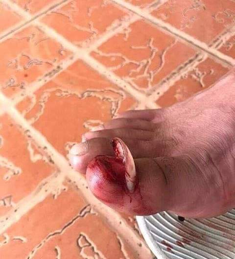 Romanus199's tweet photo. Ivi mnaosema maumivu ya mapenzi akuna cha kufananisha mnayajua maumivu vizuri ebu mniache https://t.co/rPNdJeXp3G