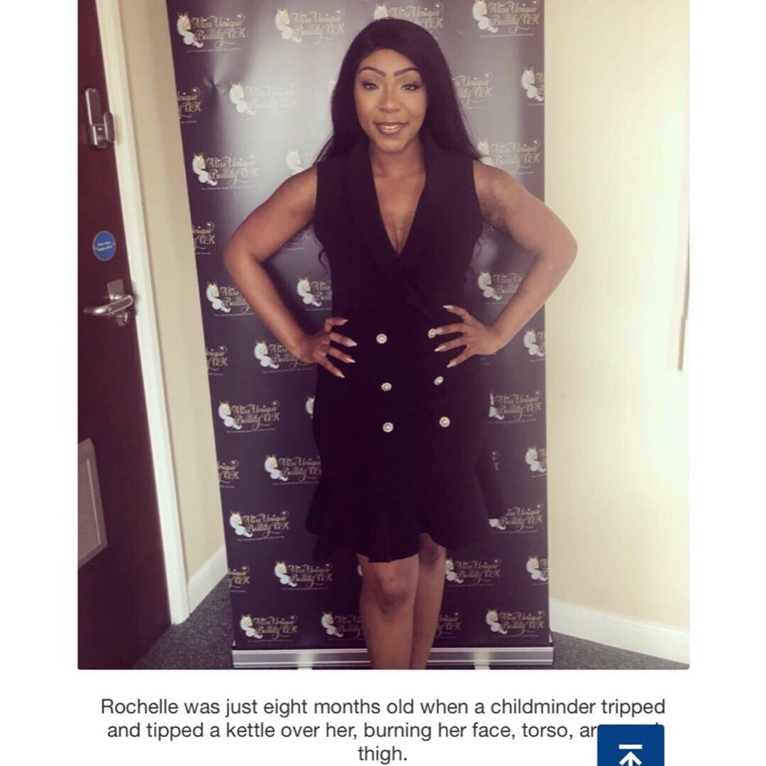 BarrettRochelle's tweet photo. Thankyou so much to Hollywood 😱😱based @meawwofficial for this lovely write up! We have to make this global! Sponsors, investors, corporate brands/businesses let’s make this happen! uphttps://meaww.com/burns-victim-rochelle-barrett-founder-miss-unique-beauty-uk-interview https://t.co/5AH4d94jSp