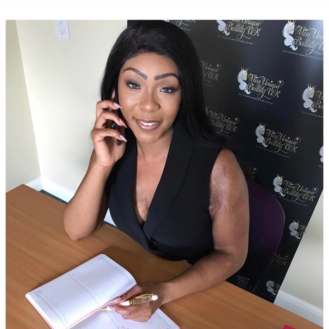 BarrettRochelle's tweet photo. Thankyou so much to Hollywood 😱😱based @meawwofficial for this lovely write up! We have to make this global! Sponsors, investors, corporate brands/businesses let’s make this happen! uphttps://meaww.com/burns-victim-rochelle-barrett-founder-miss-unique-beauty-uk-interview https://t.co/5AH4d94jSp