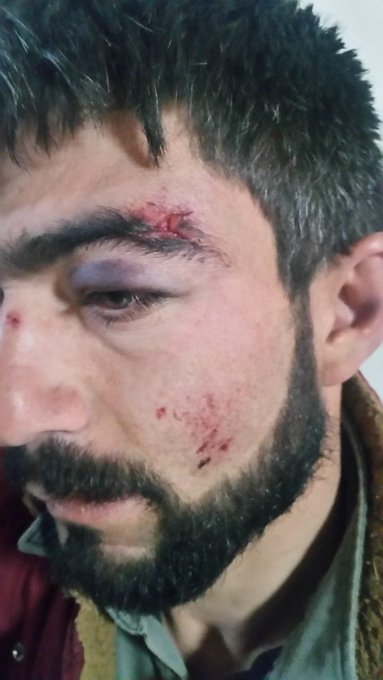 Resmi Twitter'da görüntüle