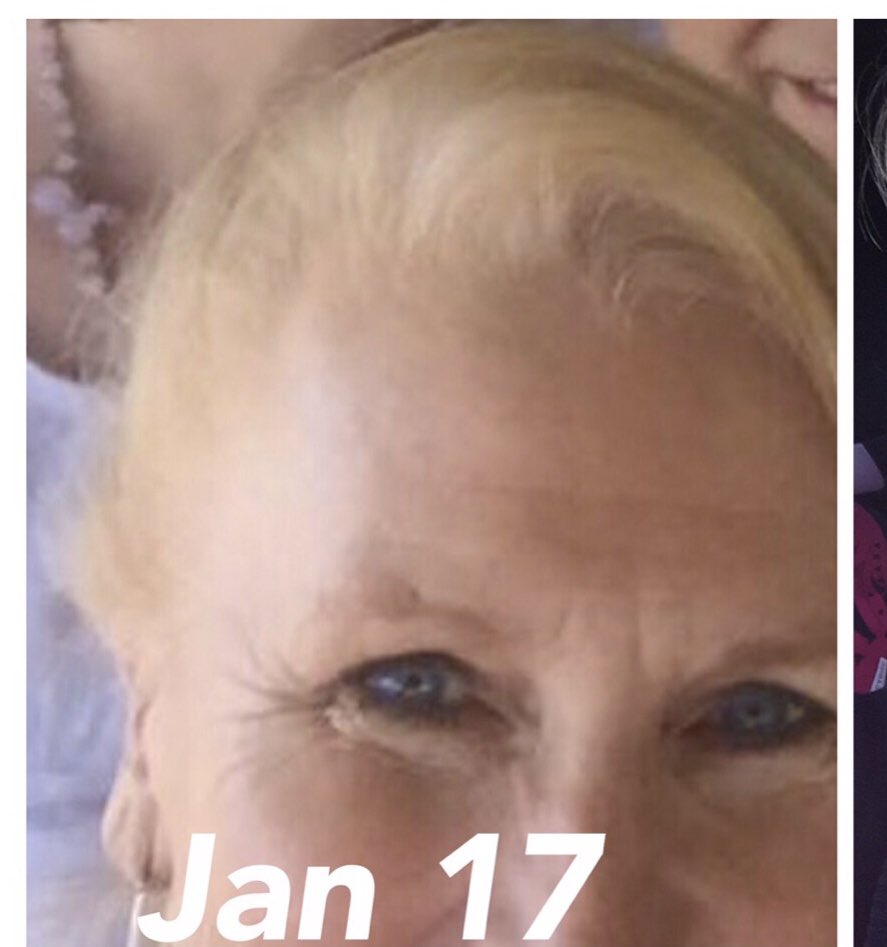 SherryKnowles17's tweet photo. Hairline receding?
Hair shedding?
Lack of volume?
I can help https://t.co/mAZ8Xagi2Y