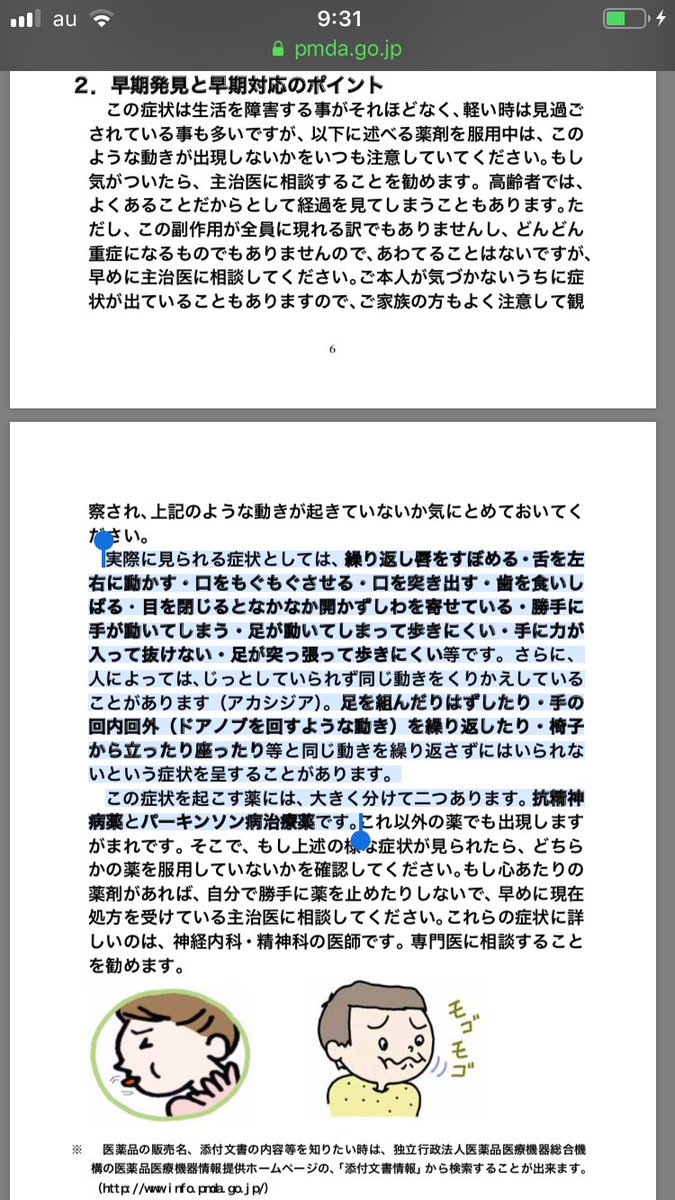 野村俊一 ジスキネジア 遅発性ジスキネジア アカシジア T Co Ikfyrrmkdk の症状があるときは 遅発性ジスキネジア が発症していること支持する 悪性症候群 T Co Sxvspkwdy4 に近い 急性のジストニア を起こす事があり この場合は生命