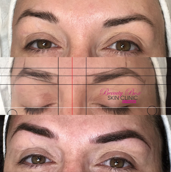 BeautyBoxMaggie's tweet photo. Before &amp; after microblading hair strokes😍

Get amazing defined brows with us!

Call Maggie on 07424716505 to book an appointment✨

#browgoals #microblading #eyebrows #Essex https://t.co/wseV8G6yAp