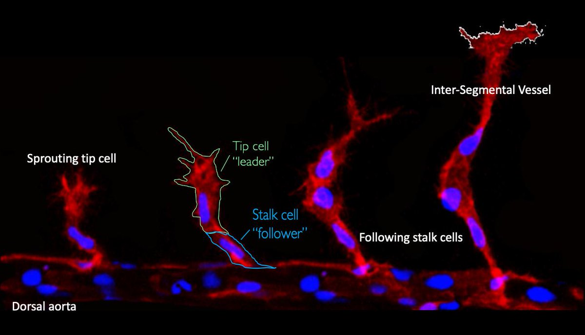 Gautam Dey (@dey_gautam) on Twitter photo With just 1 day to go, our last featured speaker is Sabrina Ghadaouia <a href="/sabrinaghd/">Dr Sabrina Ghadaouia</a> from the <a href="/HerbertLab/">Herbert Lab</a> in Manchester! She studies how endothelial cells integrate cell division with collective cell migration during zebrafish angiogenesis. <a href="/Official_BSCB/">BSCB</a> @BSocietyDevBiol #CBDB19 With just 1 day to go, our last featured speaker is Sabrina Ghadaouia <a href="/sabrinaghd/">Dr Sabrina Ghadaouia</a> from the <a href="/HerbertLab/">Herbert Lab</a> in Manchester! She studies how endothelial cells integrate cell division with collective cell migration during zebrafish angiogenesis. <a href="/Official_BSCB/">BSCB</a> @BSocietyDevBiol #CBDB19