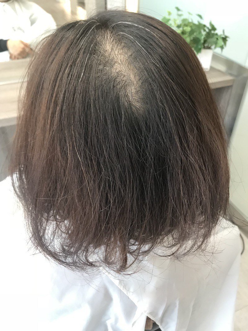 縮毛矯正 髪質改善 ヘッドスパ Zukkiy 鈴木 一哉 Zukkiyyy Twitter 縮毛矯正 髪質改善 ヘッドスパ Zukkiy 鈴木 一哉 Zukkiyyy Twitter