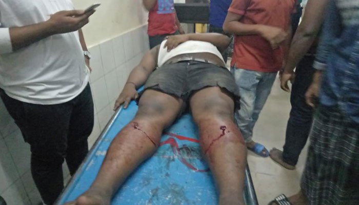 Activists of Juboleague, youth wing of the ruling #AwamiLeague, drove an electric drill on the legs of a man after he refused to pay donation demanded by them.  Pro-government groups keep committing such crimes in #Bangladesh because they know they are immune from punishment.