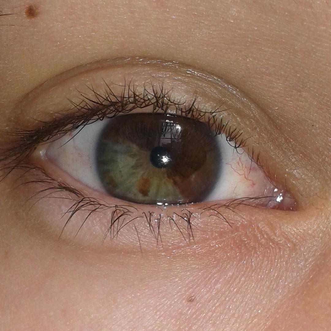 Twitter पर هوميروس Segmental Heterochromia حالة نادرة تدعى بتغاير لون القزحيتين حيث تحتوي قزحيه العين على لونين مختلفين في آن واحد Https T Co Xl29wcxjca