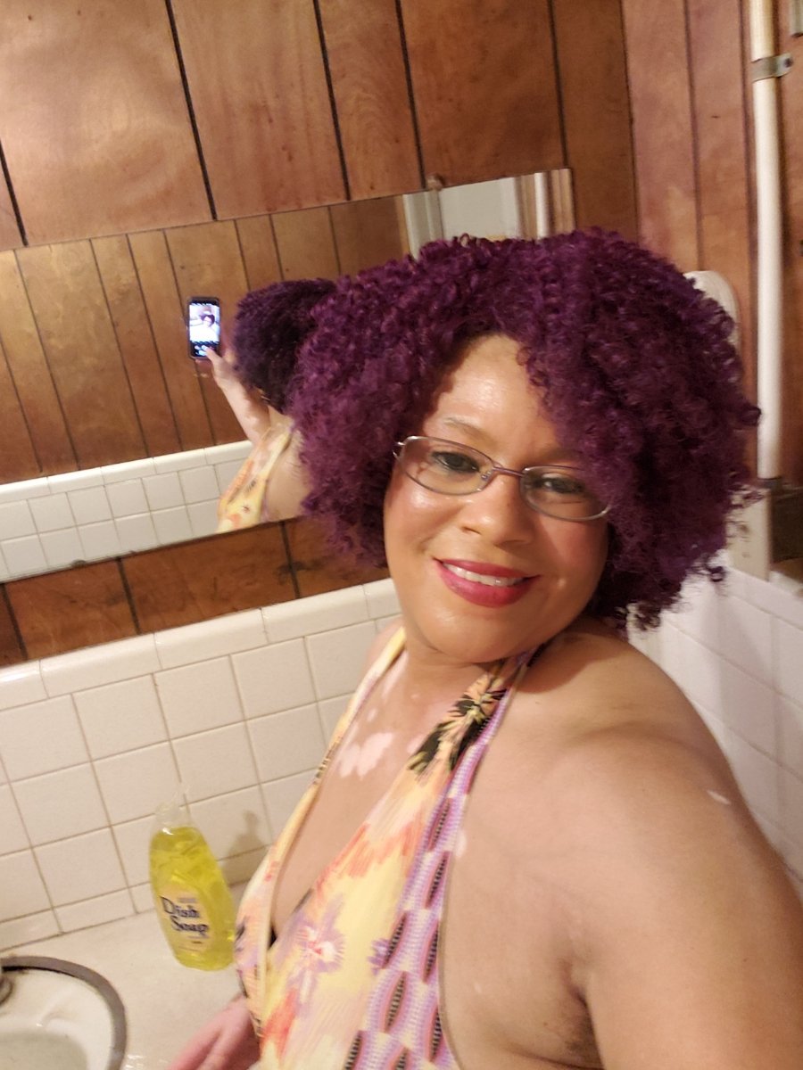 dapurplediva's tweet photo. my #Vitiligo dont Own..me I own #MySkinCondition I #WillNotHideMyVitiligo #ItsSoRareTheyStare #Borndifferentππ #BeautybothWaySππ I roc I make it look Eaze #VitiligoStrong Lake Charles Louisiana https://t.co/tiDCfJPAUr