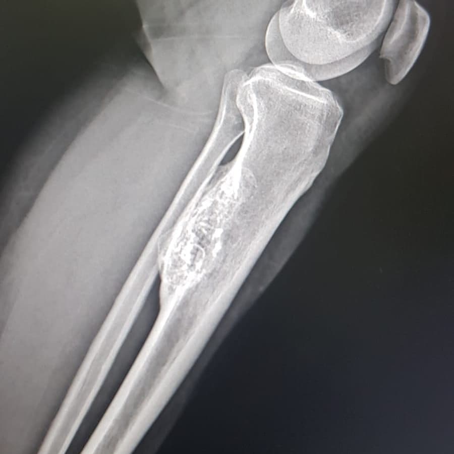 📝Diz ağrısıyla gelen 49 yaşındaki hasta
📝Ayırıcı tanı için ileri tetkik önerilir.
#radyoloji #tıbbigörüntüleme