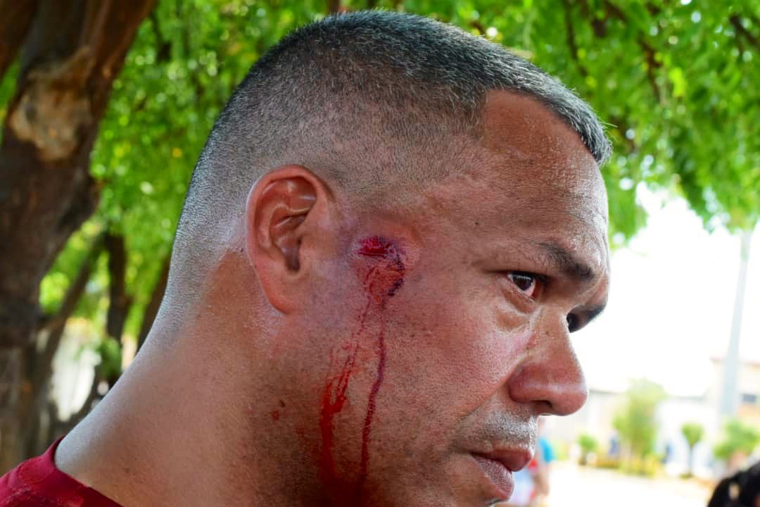 DesiBarboza's tweet image. Que Venezuela y el mundo vean como fuimos brutalmente reprimidos en el Zulia. Hasta desde un helicóptero nos lanzaron bombas lacrimógenas. 

@OmarPrietoGob y sus esbirros deben saber que los delitos de lesa humanidad no prescriben. No se confunda, pronto van a pagar.