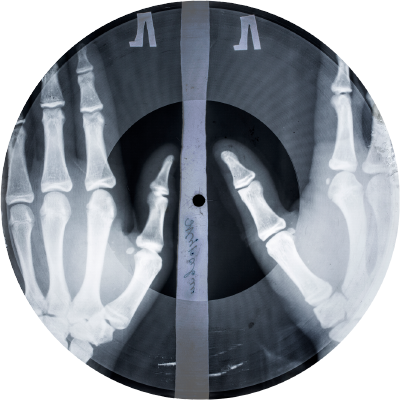 レントゲン写真のtwitterイラスト検索結果 古い順