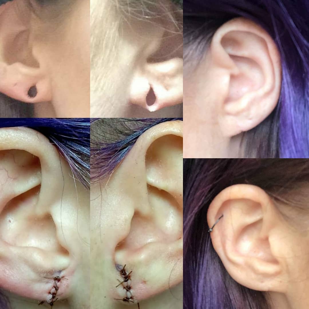 JoshPinz's tweet photo. Lobe Reconstruction update at 1 year old! Healed beautifully. Thanks for looking!
#piercer #piercing #pierced #bodymodificationartist #guyswithpiercings #guyswithtattoos #guyswithmods #girlswithpiercings #girlswithtattoos #girlswithmods #lobereconstruction #bme #bmezine #bodymod https://t.co/rOC2QVNoK4