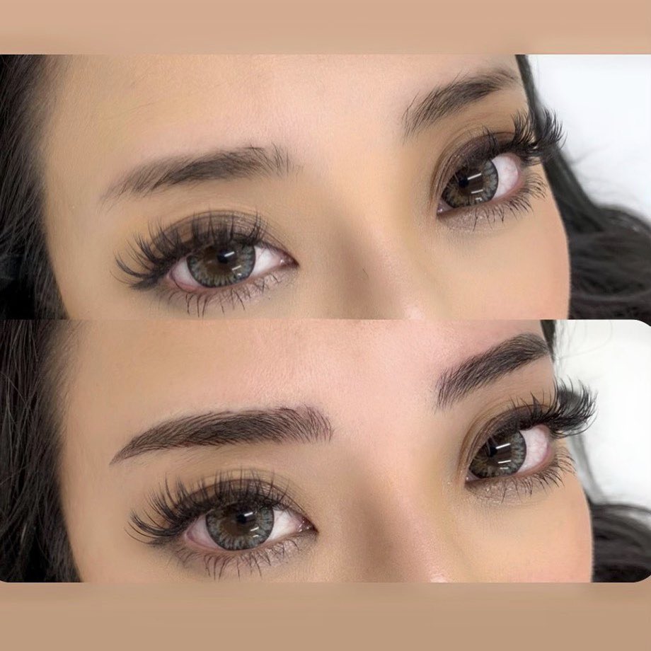 Venusbeautyclinic Twitter Search Twitter