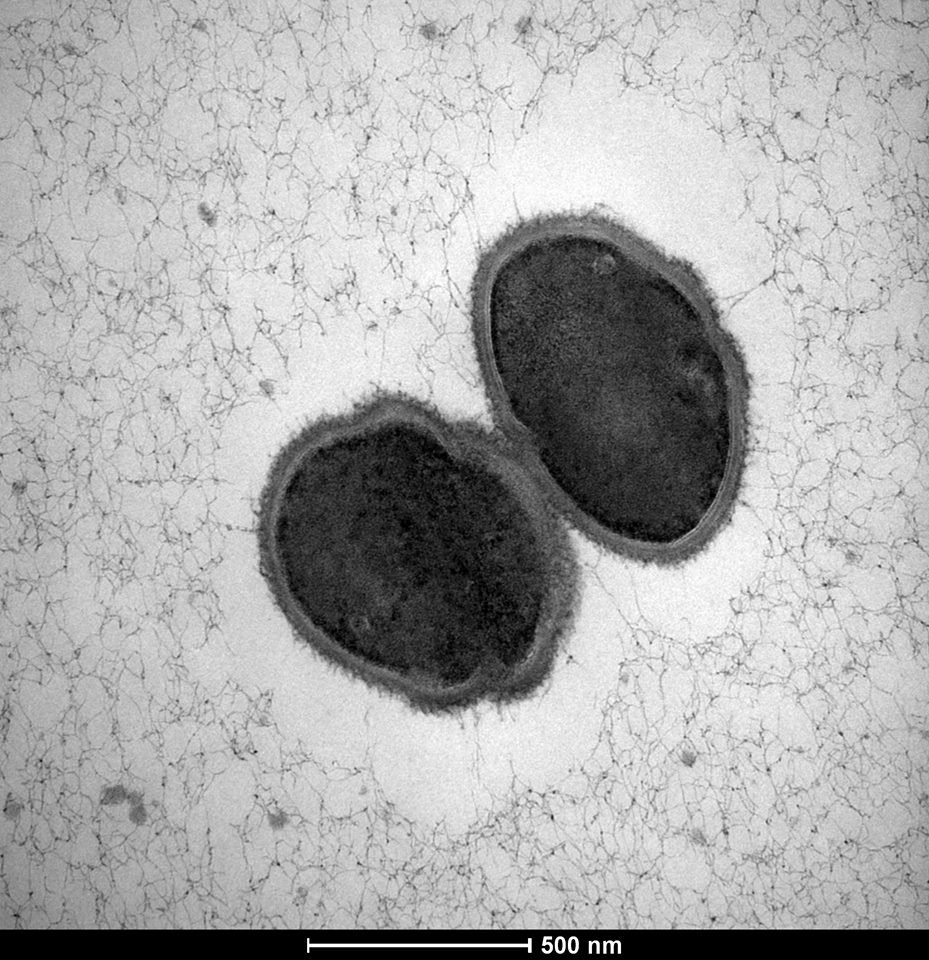 plantandfood's tweet photo. M. pectinilyticus peeling off the pectin layer from the #PlantCellWalls of #kiwifruit🥝. The #discovery suggests that the human gut #microbiome is evolving to accommodate our consumption of #fibre-rich foods.
https://t.co/93r7Vwn1ZQ
#coolscience #microscopicimage https://t.co/FDSd0myRoQ