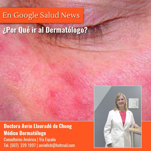 MediosonlinePA's tweet photo. Continuar con el artículo aquí https://t.co/OvAV9g4j5S #Google Salud Dermatología #Salud #Bienestar #Directorio Médico Google Salud #Vida Sana #Calidad de Vida https://t.co/NOaV9qqYUF